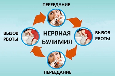 Лечение булимии в Кокреке